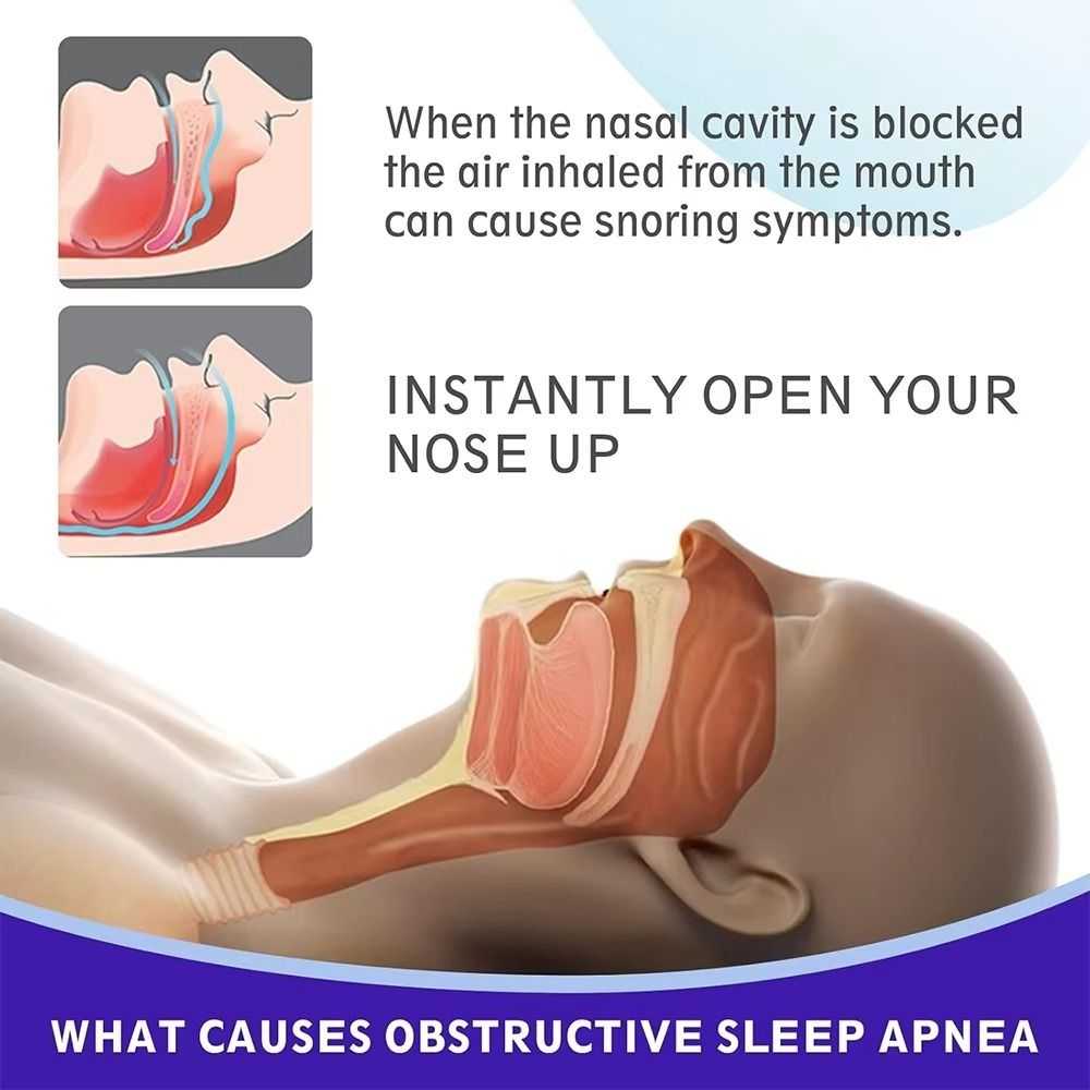 30Pcs New Hypoallergenic Nose Strips Breathable Non-Invasive Anti-Snoring Sticker Nasal Congestion Nose Patches Better Breathing